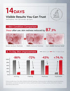 Vitamin B5 Serum – Hydrating, Soothing & Barrier Care Essence with Panthenol, Ceramides & Squalane for Sensitive Skin